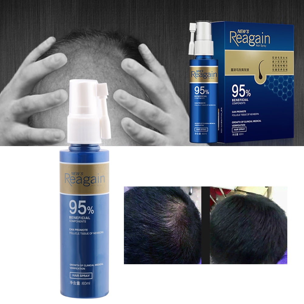 Hair Growth , Hair Growth Anti Hair Loss Liquid For People For Hair