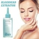 thumbnail image 4 of Cujmh Blackhead Remover Pore Cleanser Oil Control Gentle Deep Cleansing Liquid Skincare Treatment, 4 of 4