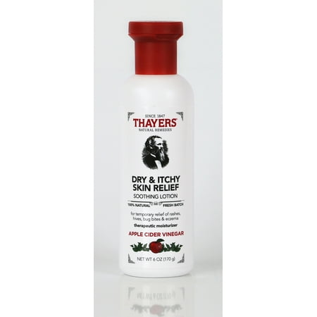 soothing lotion thayers itchy relief oz dry skin