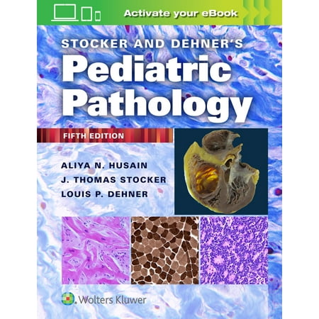 UPC: 9781975144814 | Stocker and Dehner s Pediatric Pathology (Edition 5) (Hardcover)