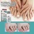 thumbnail image 1 of Nail Onycho Liquid Nail, 1 of 4