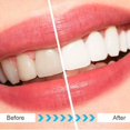 thumbnail image 4 of 25 cabezales de repuesto para cepillo de dientes Fairywill/Seago, cabezal de cepillo de dientes eléctrico para, 4 of 4