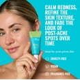 thumbnail image 2 of Tratamiento de Ácido Azelaico Good Molecules 10% para el Rostro 30 mL, 2 of 7