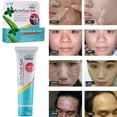thumbnail image 1 of Crema para Eliminar Espinillas Hot6sl Ofertas y Liquidaciones Cuidado de La Piel 35 G, 1 of 7