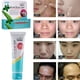 thumbnail image 1 of Crema para eliminar Manchas de espinillas Fiudx 35g Cuidado de la Piel, 1 of 7
