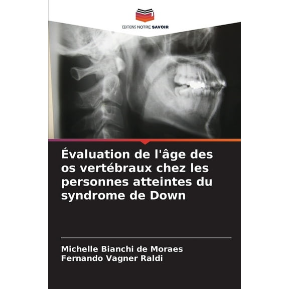 Évaluation de l'âge des os vertébraux chez les personnes atteintes du syndrome de Down, (Paperback)