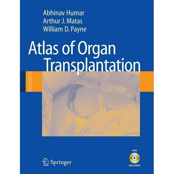 Atlas of Organ Transplantation, (Paperback)