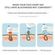 thumbnail image 5 of Seitruly Belleza Facial cuidado de la piel vacío instrumentos de espinillas portátil USB recargable poros limpieza removedor hogar Cuerpo del baño, 5 of 6