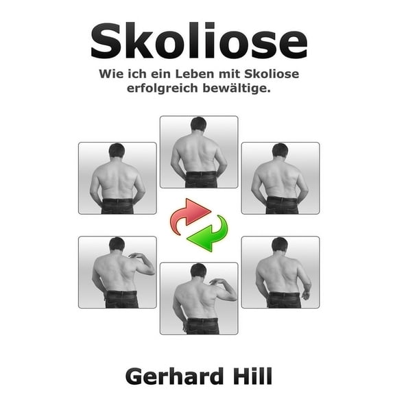 Skoliose: Wie ich ein Leben mit Skoliose erfolgreich bewÃ¤ltige, (Paperback)