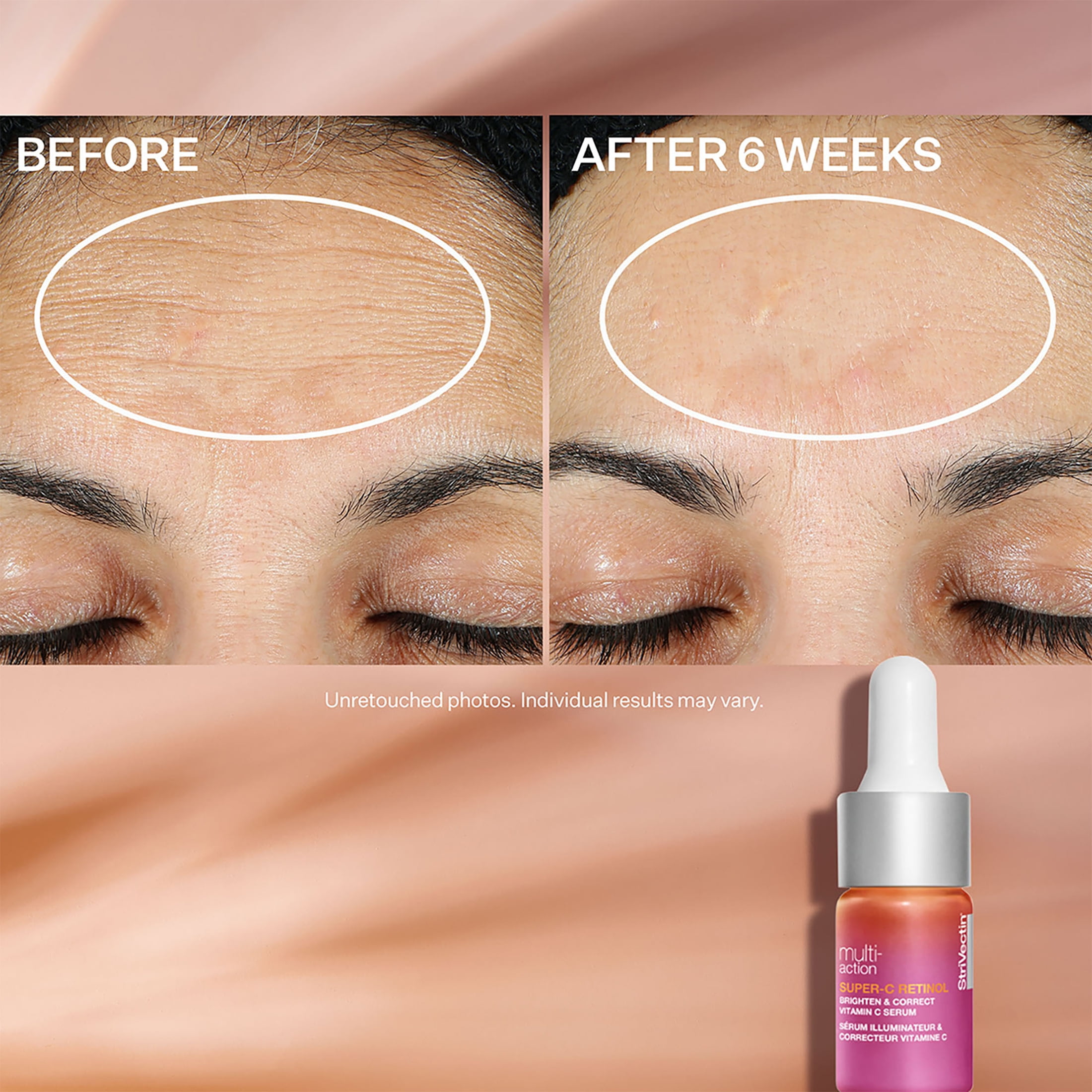 StriVectin Multi-Action Trio: Brighten & Restore Kit, 3 Pieces
