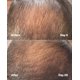 thumbnail image 2 of Sérum para el tratamiento del cuero cabelludo SickScience PowerCycle 60 ml, 2 of 8