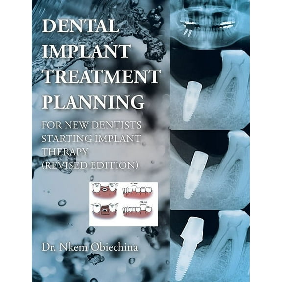 Dental Implant Treatment Planning for New Dentists Starting Implant Therapy
