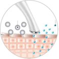 thumbnail image 4 of Anti-wrinkle Eye Massager Face Massager Massager Against Wrinkles And Dark Circles Anti Aging Remove Dark Circles, 4 of 5