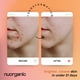 thumbnail image 5 of Mascarilla facial nuorgánica con cúrcuma, calmante para el acné, aclara los poros, 5 of 6