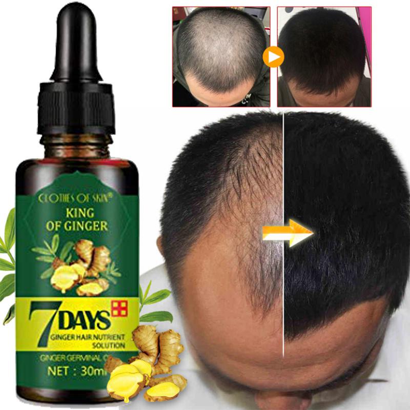 ACEITE ESENCIAL PARA EL CABELLO 7 DÍAS - Walmart.com