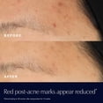 thumbnail image 3 of Estee Lauder Advanced Night Repair Rescue Solution 20ml, 3 of 5