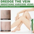 thumbnail image 3 of Crema para venas varicosas, gel de compresa fría para circulación venosa, 3 of 7