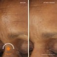 thumbnail image 3 of Paquete de cuidado de la piel RoC Retinol Correxion Deep Wrinkle, 3 of 7