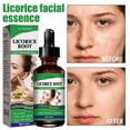 thumbnail image 1 of 1/2 Pcs Sérum Facial Réducteur de Pores Extrait de Racine de Réglisse Essentiel Anti-Acné Huile, 1 of 5