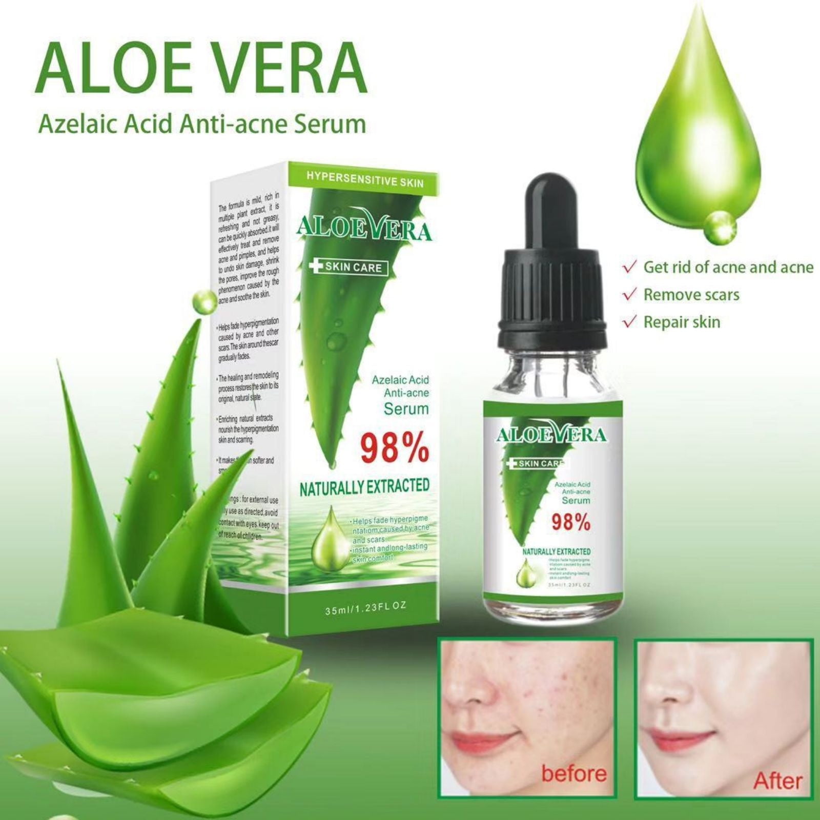 Aloe Vera Gel Facial Acne Removal Liquid Moisturizing Moisturizing Balance Oil Repair Essence 35ml