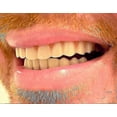 thumbnail image 4 of Instant Smile Comfort Fit Flex Teeth - Upper And Lower Matching Set Natural Shade! Fix Your Smile At Home Within Minutes!, 4 of 4