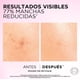 thumbnail image 5 of L'ORÉAL PARIS SKIN Kit anti-manchas Glycolic Bright: Sérum 30ml + Crema día 50ml con Melasyl, 5 of 8