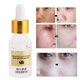thumbnail image 3 of Baba De Caracol Esencia Facial ANGGREK Suero Hidratante 15ml, 3 of 8