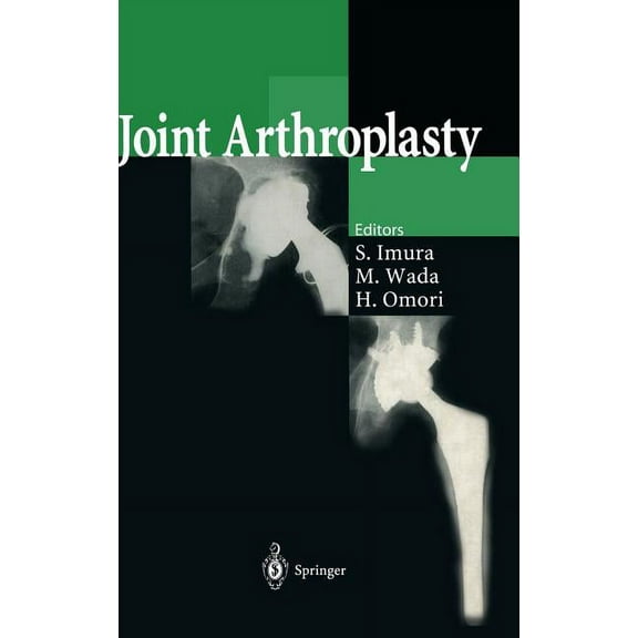 Joint Arthroplasty, (Hardcover)