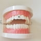 thumbnail image 4 of Venta caliente 4 piezas médicas de titanio puro dientes gemas cinco hojas slover dientes joyería superventas dientes gemas, 4 of 4