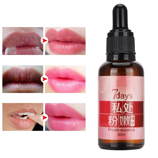 Suero blanqueador ANGGREK para Eliminar melanina 30ml Parte Privada para mujeres