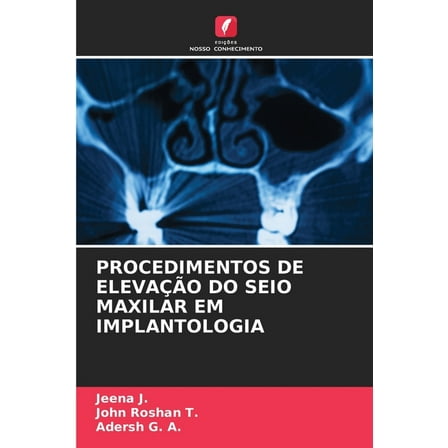 Procedimentos de ElevaÃ§Ã£o Do Seio Maxilar Em Implantologia, (Paperback)