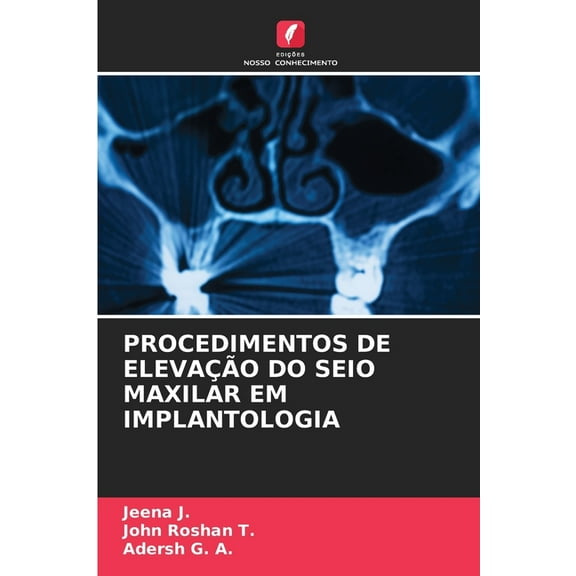 Procedimentos de ElevaÃ§Ã£o Do Seio Maxilar Em Implantologia, (Paperback)