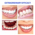 thumbnail image 5 of Lápiz blanqueador de dientes (2 unidades), más de 20 usos, eficaz, indoloro, sin sensibilidad, fácil de usar, fácil de usar, hermosa sonrisa blanca, sabor a menta natural Afortunado Sencillez, 5 of 5