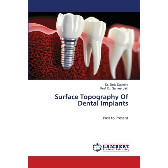 Surface Topography Of Dental Implants, (Paperback)