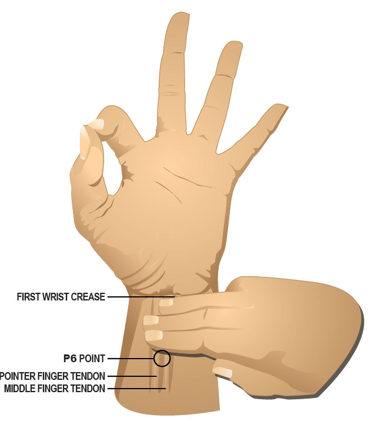 NoMo Nausea Bands Large Nude