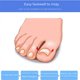 thumbnail image 3 of Parche para uñas, ranura para uñas, dispositivo de corrección de uñas, hebilla para uñas, parche para uñas, parche corrector de uñas, corrección de uñas, 3 of 5