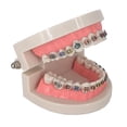 thumbnail image 4 of Modelo Avanzado de Ortodoncia con Soportes Metálicos Duraderos, 4 of 5