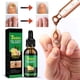 thumbnail image 2 of Skin Maximum para uñas de manos y pies, 30 ml. Cuidado intensivo de las uñas. Solución para uñas con jengibre, 2 of 8
