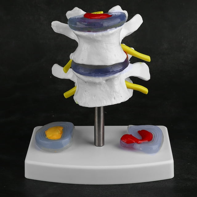 Filfeel Spine Model, PVC Durable Human Lumbar Model, More Clearly For Home Room Office Outdoor