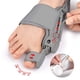 thumbnail image 5 of Ortesis Hallux Valgus Juanetes Protrusión Ósea Del Pie Separador Dedos Superpuesto Ortesis Ajustable A Presión (gris), 5 of 9