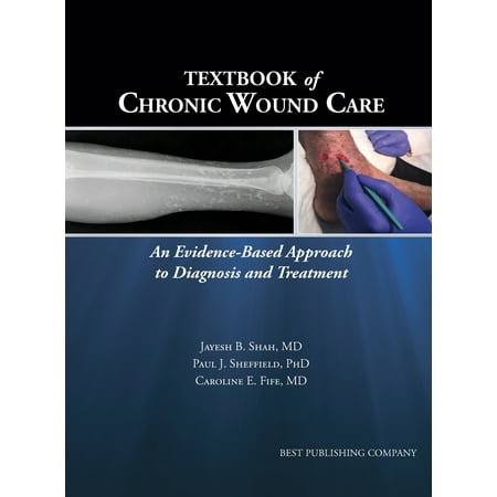 Textbook Of Chronic Wound Care (Best Treatment For Chronic Bv)