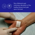 thumbnail image 2 of 3M? Tegaderm? +Pad Film Dressing with Non-Adherent Pad, 6 x 6 Inch, 1/Each (360349_EA), 2 of 6