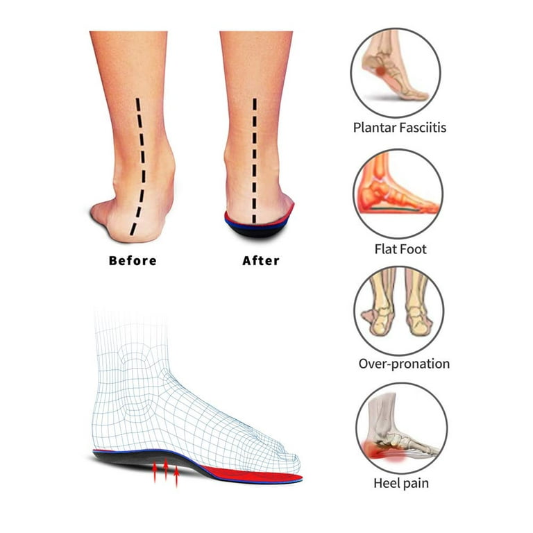PCSsole Comfort Arch Support Insoles,Foot Supportive Orthotic Shoe