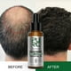 thumbnail image 2 of Aceite de romero Fast For Hair Aceite esencial Jengibre Anti Hair Loss Serum 50ml, 2 of 11
