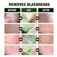 thumbnail image 2 of Mascarilla de barro de té verde transfronteriza Eelhoe, hidratante, limpia los poros, mascarilla para rejuvenecer la piel, cuidado de la piel, 3 piezas, 2 of 4