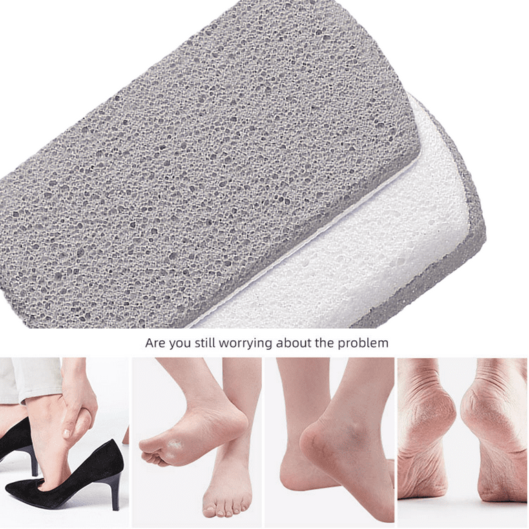 The Original Pumice Stone for Feet and Foot File Set – Rust-Resistant  Stainless Steel Foot Scrubber, Scraper, or Callus Remover and Stone Help  Smooth