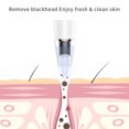 thumbnail image 4 of Extractor Eléctrico de Puntos Negros con 6 Boquillas Intercambiables para Limpieza Facial Profunda, Tecnología de Succión al Vacío, Batería Recargable USB, Diseño Ergonómico para Todo Tipo de Piel., 4 of 6