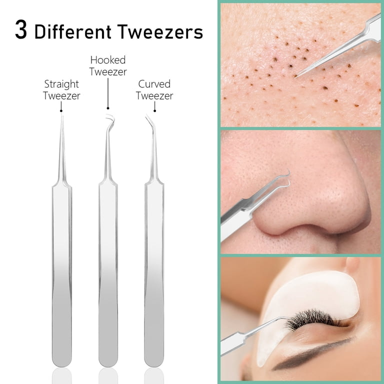 Pinkiou Blackhead Extraction Tool Kit, 8-Piece Set photo 3
