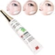 thumbnail image 1 of Crema para eliminar pecas, crema para atenuar manchas, diseño unisex, 30 g, para el cuidado de la piel, eliminación de manchas oscuras, crema blanqueadora para la piel del rostro, pigmentación de la, 1 of 5
