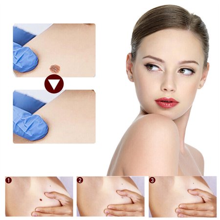 Wipe Off Skin Tags & Moles Removal Quick Safe Remover Restore Skin HOT AU